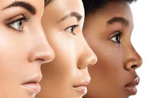 Genetic and Ethnic Background wide noses