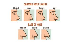 Variations in Rhinoplasty: